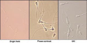 Photo of Rottweiler stud semen using bright field, phase contrast...